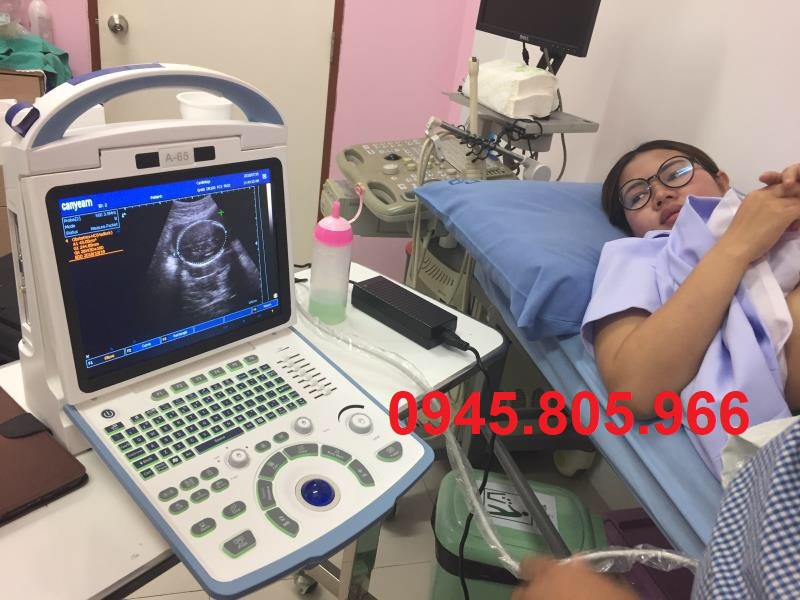 Bảng Báo Giá Máy siêu âm xách tay mới nhất năm 2023 - Hàng chất lượng cao